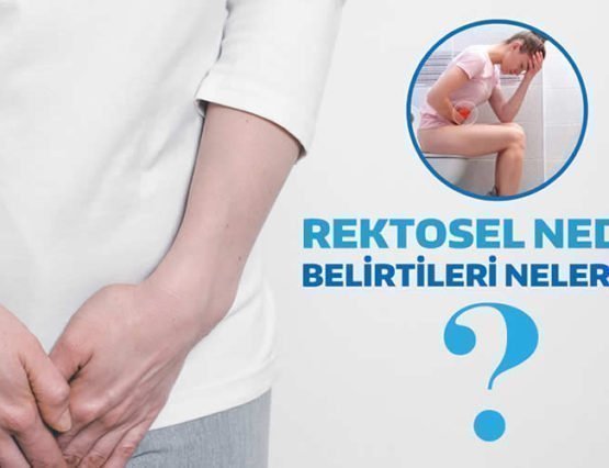 rektosel